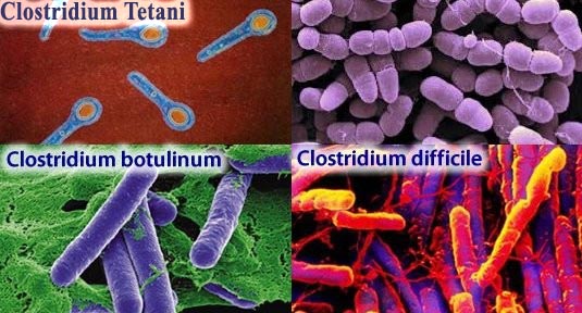 Botoks Toksini - Closridium Botulinum, Tetani, Difficile