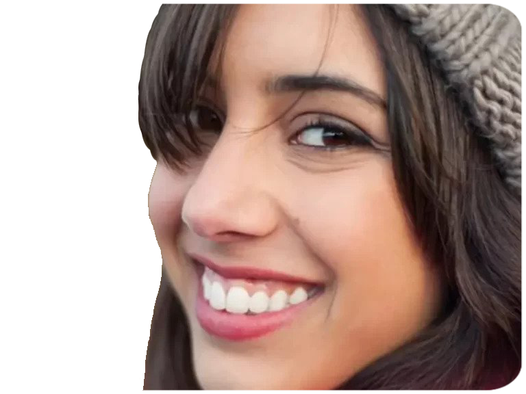 Gummy Smile Botoksu - Diş Eti Gülümsemesinin Botoks ile Tedavisi Gummy Smile Botoksu - Diş Eti Gülümsemesinin Botoks ile Tedavisi